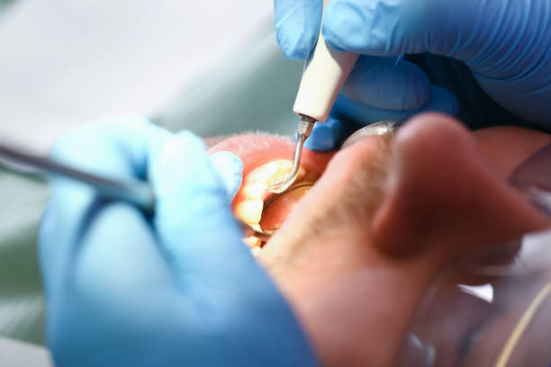Best Emergency Dental Filling Replacement  in Grant, MN